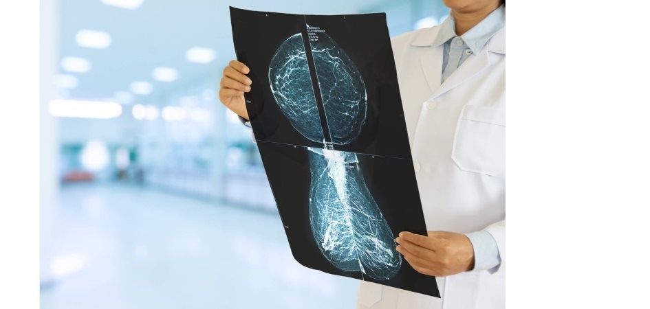 Математики ЧелГУ работают над эффективной методикой ранней диагностики рака груди